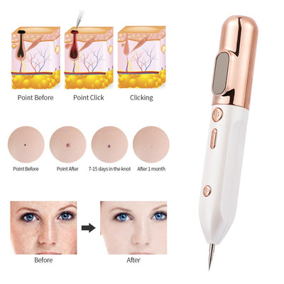 Blue light acne device with before and after skin treatment results and acne removal process diagrams